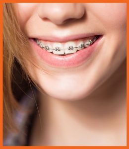 Composite fillings palmdale